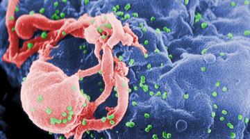 Scanning electron micrograph of HIV-1 (in green) budding from a cultured lymphocyteImage: U.S. Centers for Disease Control