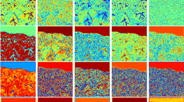 Activation maps of neural network model for digital staining of tumorsImage courtesy of the researchers.