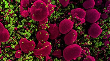Colorized scanning electron micrograph of an apoptotic cell (pink) heavily infected with SARS-COV-2 virus particles (green). MIT researchers are using computational models of protein interactions to design a peptide that can bind to coronaviru...