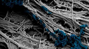 A scanning electron microscope image of cultured neural cells shows the team’s newly developed nanodiscs (colored area) arrayed along the cell surface, where they can exert enough force to trigger a response.Image courtesy of the researchers