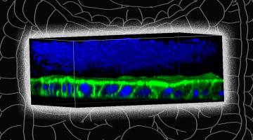 MIT biological and mechanical engineers have designed a specialized device in which they can grow oxygen-intolerant bacteria in tissue that replicates the lining of the colon. F. prausnitzii bacteria (blue, at top of image) grow above a layer o...